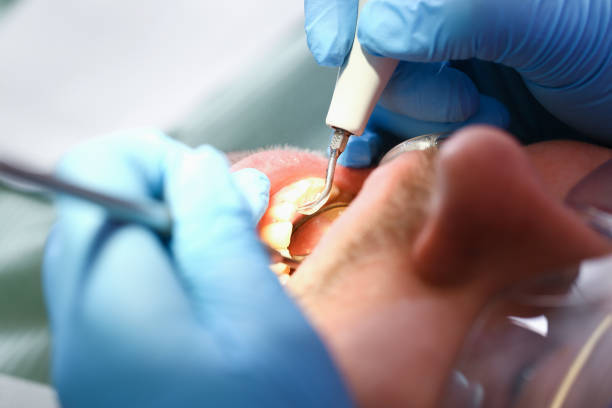 Best Dentist for Tooth Abscess  in Midway City, CA