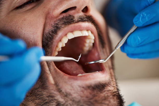 Best Dentist for Severe Toothache  in Midway City, CA